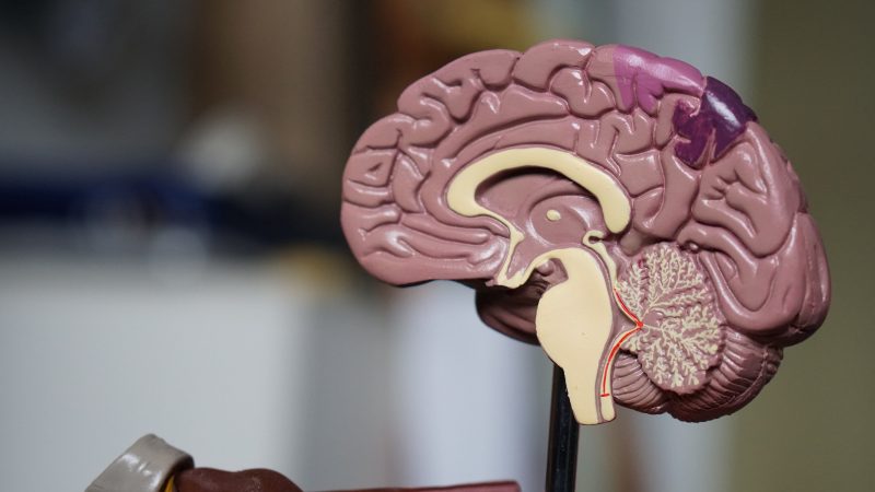 7 Ways to Overcome Hypochondriac Brain Tumor Thoughts