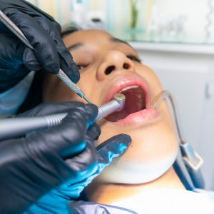 Tooth Pain When Biting Down on Crown: Normal or Not?